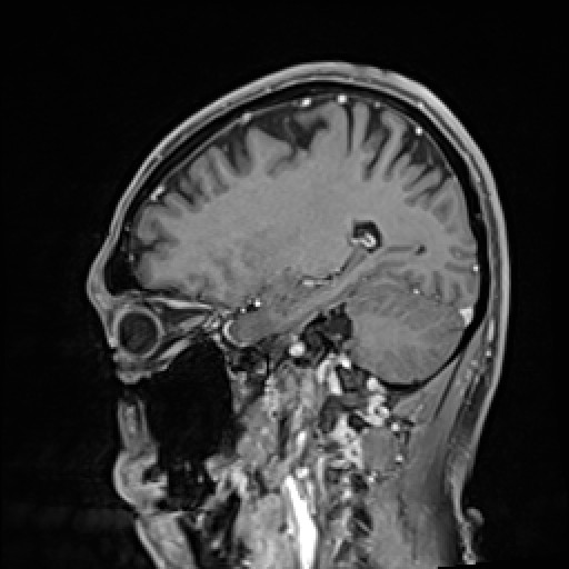 Click on the Serie image to view the images of VILLANUEVA, WILLIAM A.